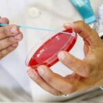Vacuna del VPH podría reducir hasta un 80% riesgo de cáncer de cuello uterino.